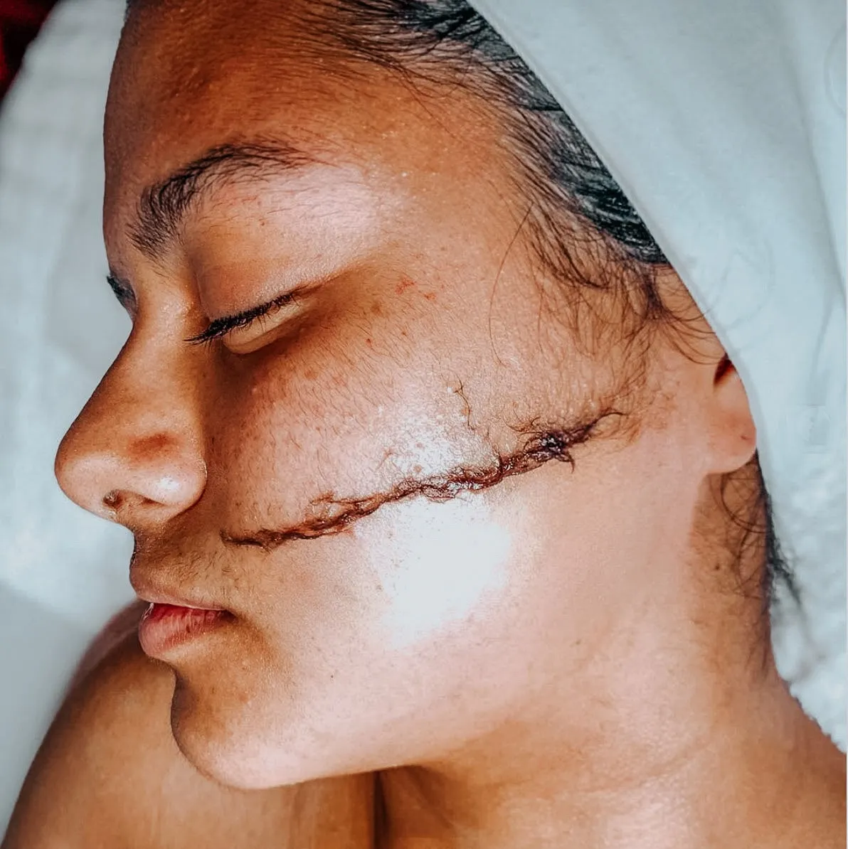 Limpieza facial profunda